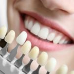 The Top Five Steps For Doing Dental Implants The Right Way